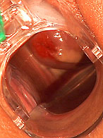 Hot bitch stuffin speculum her cunt and gets facial