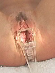 Jennifer shows her pussy inside by a speculum