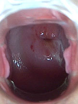 Janet fingering her asshole and toying with speculum