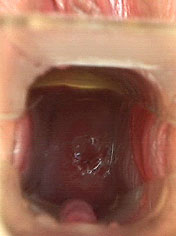 Nasty teen bitch dildoing and toying with speculum