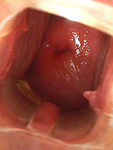 Blackhaired babe playing with speculum and toying