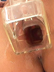 Sexy pornstar in pussystretching scene by speculum